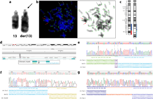 Fold-back mechanism originating inv-dup-del rearrangements in chromosomes 13 and 15.