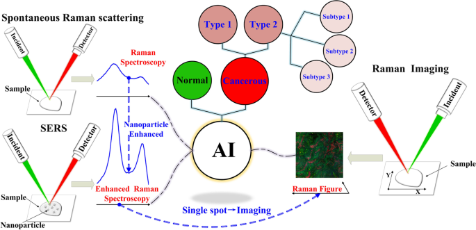 Recent application of Raman spectroscopy in tumor diagnosis: from conventional methods to artificial intelligence fusion