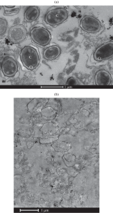 Effect of the Bacteriocin Subtilosin P19 on Bacillus anthracis Spores