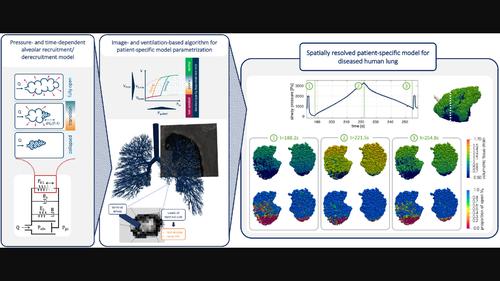 Pressure- and time-dependent alveolar recruitment/derecruitment in a spatially resolved patient-specific computational model for injured human lungs