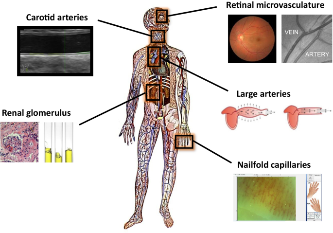 Clinical Significance of Altered Vascular Morphology and Function in Normotension.