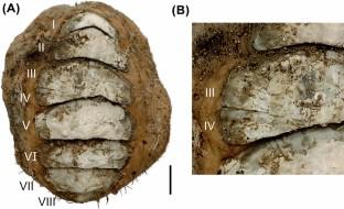 Morphometrics of teratological specimens from two species of Plaxiphora (Mollusca, Polyplacophora) from the South Pacific Ocean