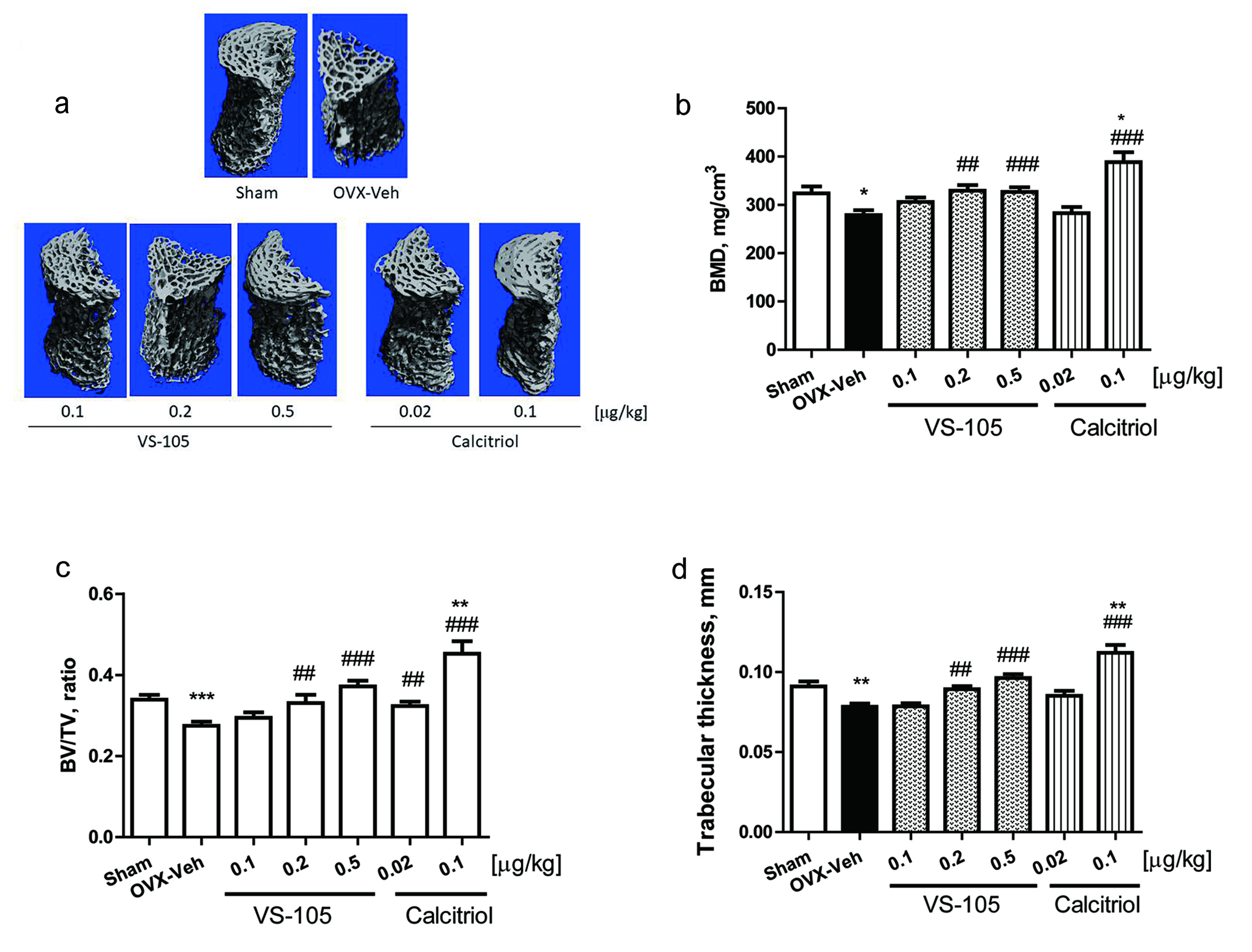 A Novel Vitamin D Receptor Agonist, VS-105, Improves Bone Mineral Density without Affecting Serum Calcium in a Postmenopausal Osteoporosis Rat Model.