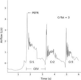 Sensorimotor Cough Dysfunction in Cerebellar Ataxias.