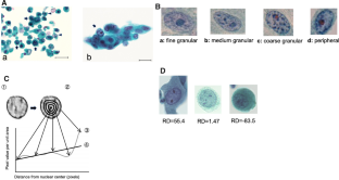 Translocation of nuclear chromatin distribution to the periphery reflects dephosphorylated threonine-821/826 of the retinoblastoma protein (pRb) in T24 cells treated with Bacillus Calmette-Guérin.