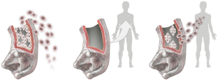 Advantages and challenges in processing and quality control of decellularized heart valves.