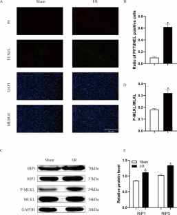 Resveratrol ameliorates myocardial ischemia/reperfusion induced necroptosis through inhibition of the Hippo pathway.