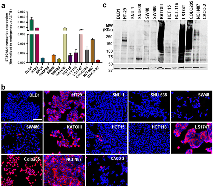 ST3GalIV drives SLeX biosynthesis in gastrointestinal cancer cells and associates with cancer cell motility.