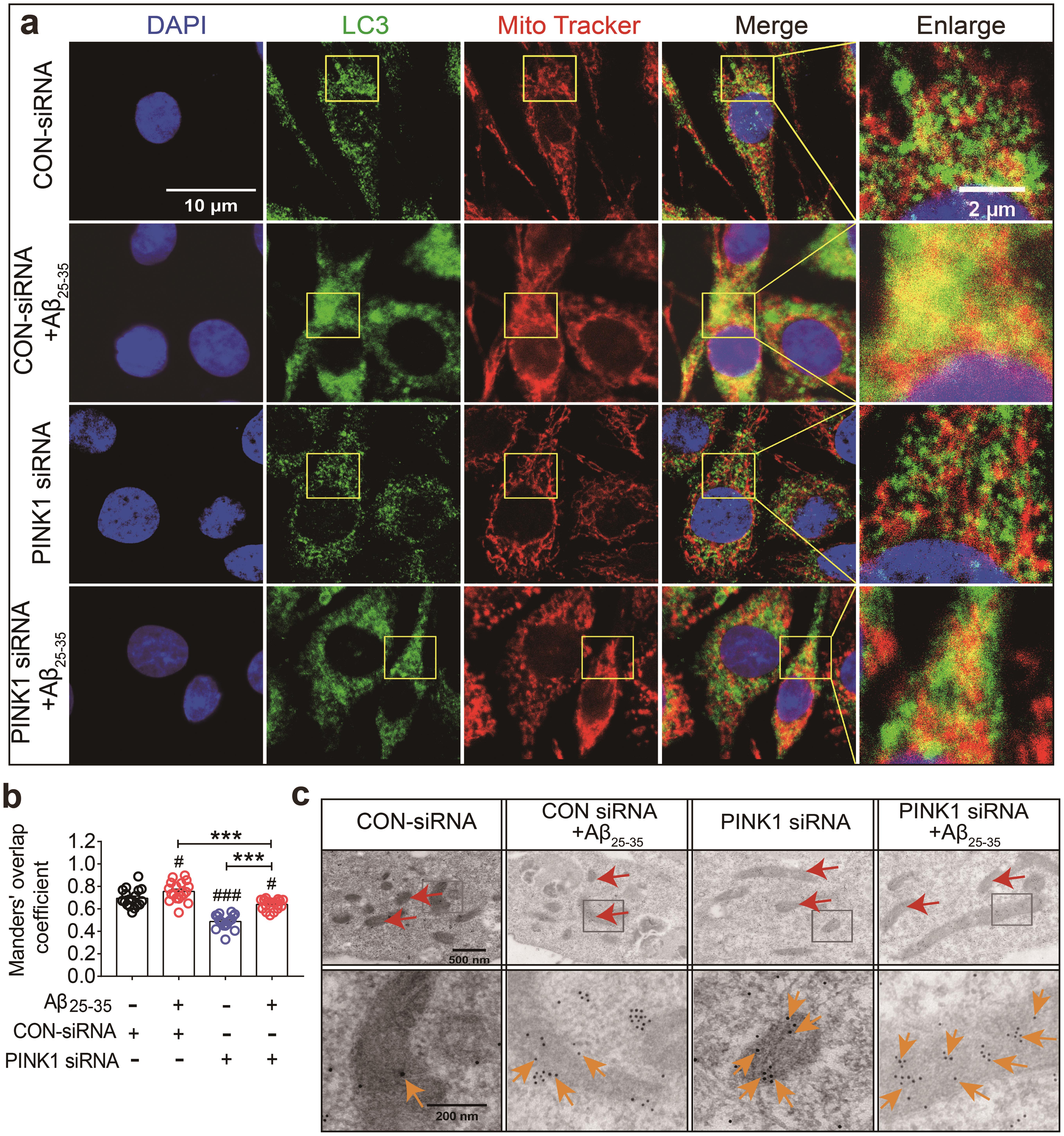 PINK1 Deficiency Aggravates the β-amyloid-attenuated Mitophagy-lysosomal Degradation in PC12 Cells