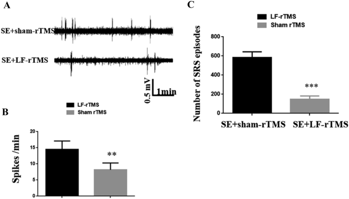 Transcriptome Sequencing of CeRNA Network Constructing in Status Epilepticus Mice Treated by Low-Frequency Repetitive Transcranial Magnetic Stimulation