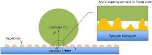 A multi-asperity adhesive contact model for catheter and vascular artery contact in endovascular surgery