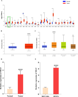 lncRNA MIAT promotes luminal B breast cancer cell proliferation, migration, and invasion in vitro.