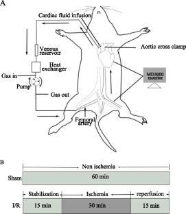 PDHA1 Alleviates Myocardial Ischemia-Reperfusion Injury by Improving Myocardial Insulin Resistance During Cardiopulmonary Bypass Surgery in Rats.