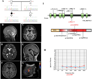 A novel biallelic variant further delineates PRDX3-related autosomal recessive cerebellar ataxia.