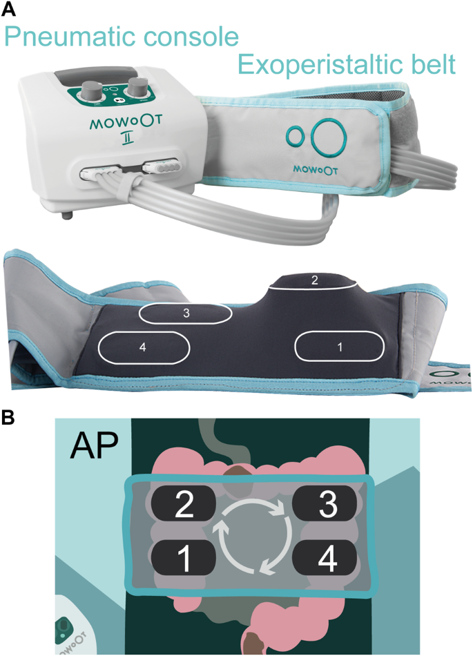 Intermittent colonic exoperistalsis for chronic constipation in spinal cord-injured individuals. A long-term structured patient feedback survey to evaluate home care use.