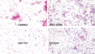 <i>Lactobacillus iners</i> and genital health: molecular clues to an enigmatic vaginal species.