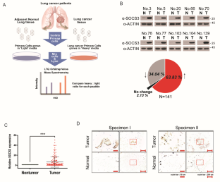 E3 ligase SOCS3 regulates NOD2 expression by ubiquitin proteasome system in lung cancer progression.