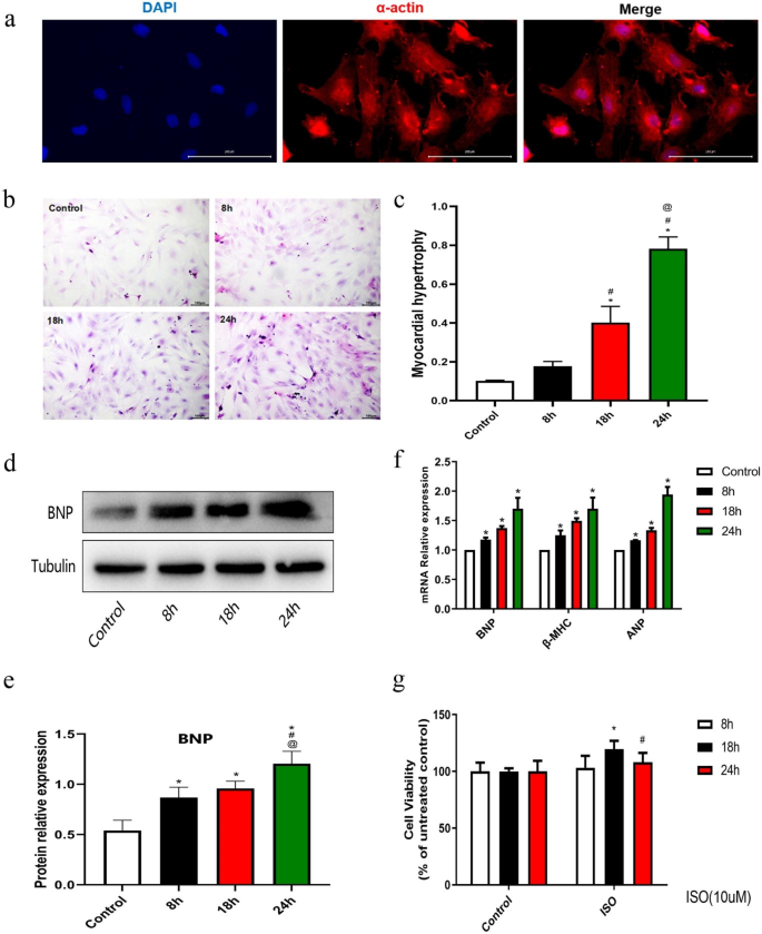 LOC102549726/miR-760-3p network is involved in the progression of ISO-induced pathological cardiomyocyte hypertrophy via endoplasmic reticulum stress