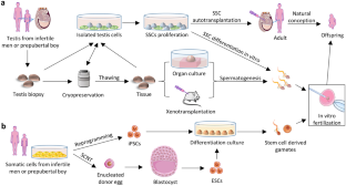 In vitro spermatogenesis in artificial testis: current knowledge and clinical implications for male infertility.