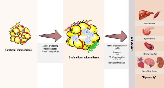 Towards an adiposity-related disease framework for the diagnosis and management of obesities.