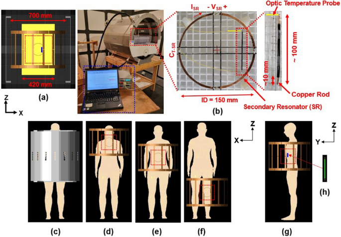 A new method to improve RF safety of implantable medical devices using inductive coupling at 3.0 T MRI.