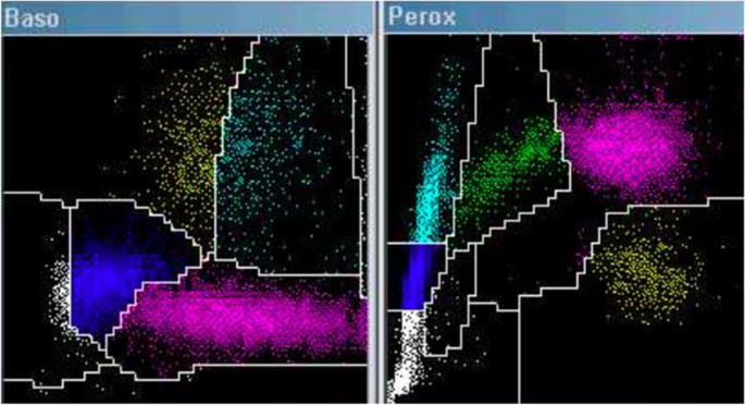 Correction to: Another cause of pseudobasophilia: flower cells.