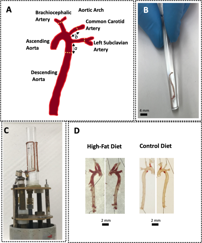 High-field magnetic resonance microscopy of aortic plaques in a mouse model of atherosclerosis.