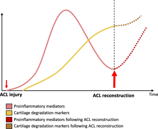 From Inflammation to Resolution: Specialized Pro-resolving Mediators in Posttraumatic Osteoarthritis.