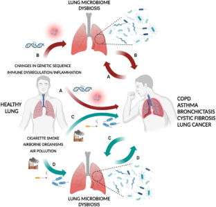 Lung Microbiome as a Treatable Trait in Chronic Respiratory Disorders.