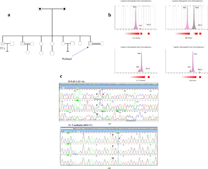 A novel compound heterozygous of β-thalassemia with HbG-Coushatta: case report of Iran.