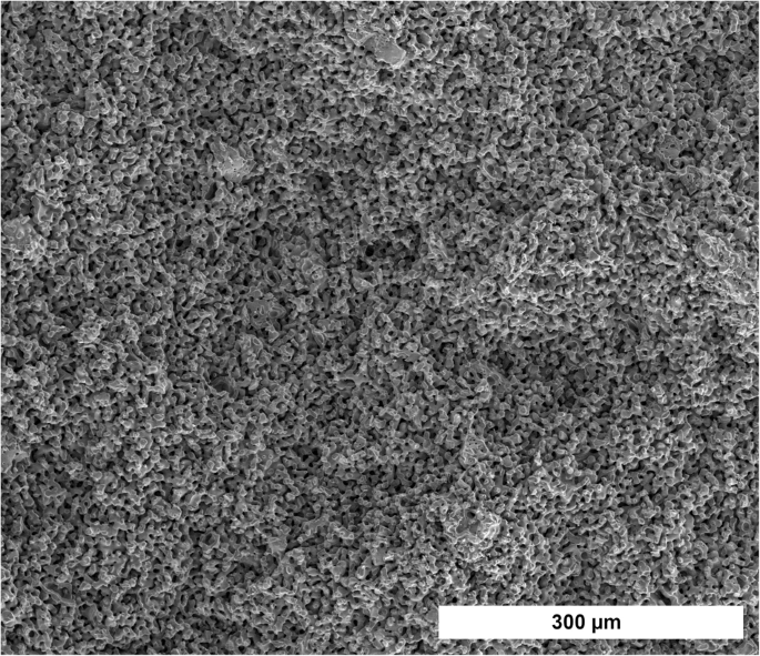 Composite material consisting of microporous beta-TCP ceramic and alginate-dialdehyde-gelatin for controlled dual release of clindamycin and bone morphogenetic protein 2