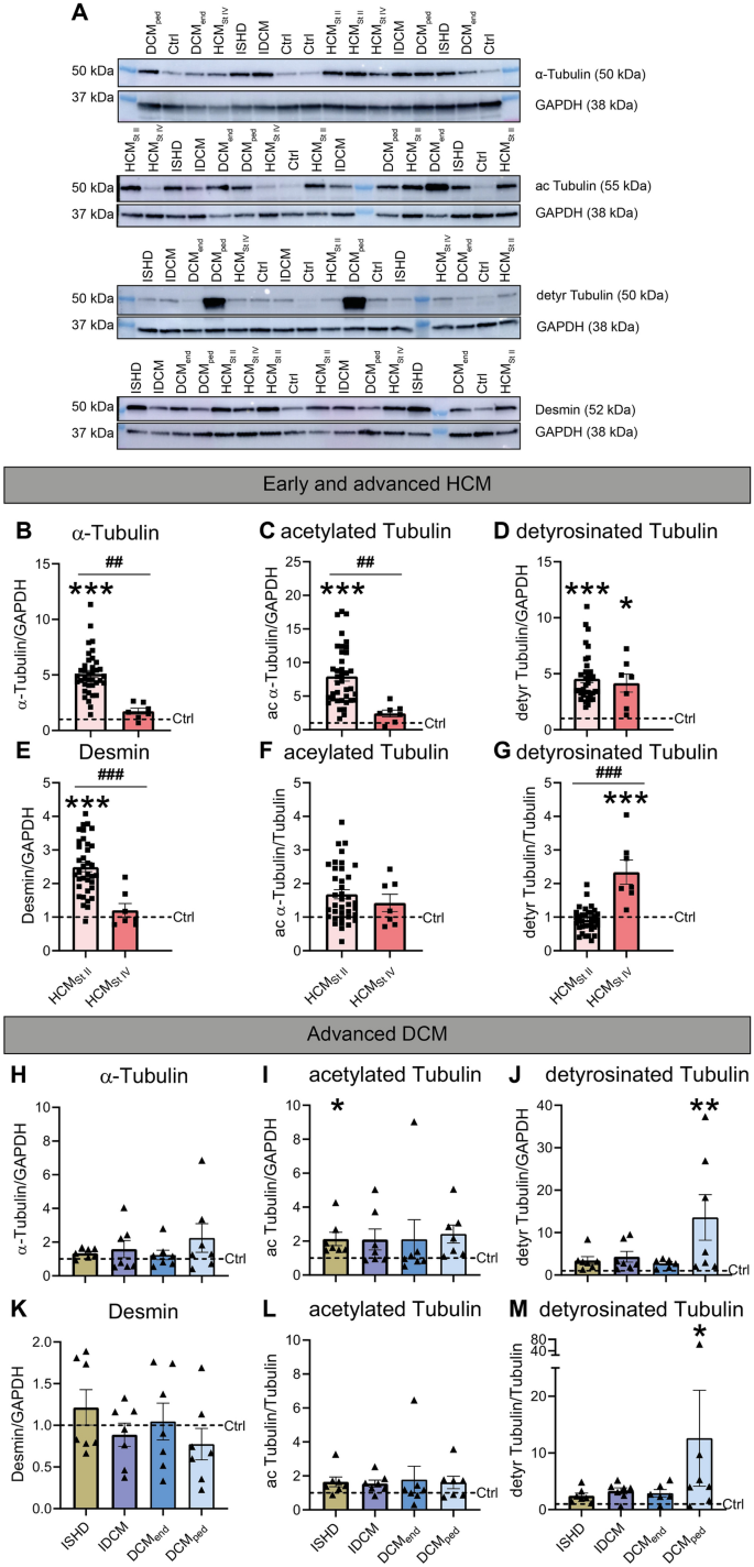 The microtubule signature in cardiac disease: etiology, disease stage, and age dependency.