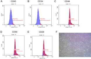 Screening and identification of differential-expressed RNAs in thrombin-induced in vitro model of intracerebral hemorrhage.