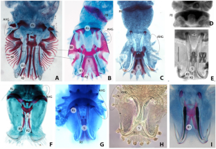 Position of Polyclithrum within Gyrodactylidae (Monogenoidea): incongruences between morphological and molecular phylogenies.