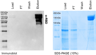 Prenatal SARS-CoV-2 Spike Protein Exposure Induces Autism-Like Neurobehavioral Changes in Male Neonatal Rats.