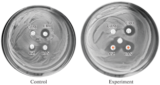 Mechanisms of Resistance to Clinically Significant Antibiotics in Bacillus Strains Isolated from Samples Obtained from a Medical Institution