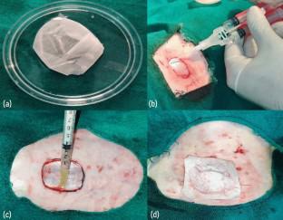 Evaluation of bone marrow-derived mesenchymal stem cells with eggshell membrane for full-thickness wound healing in a rabbit model.