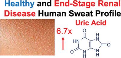 Identification of end‐stage renal disease metabolic signatures from human perspiration