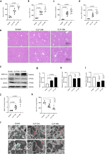 GPR116 promotes ferroptosis in sepsis-induced liver injury by suppressing system Xc<sup>-</sup>/GSH/GPX4.