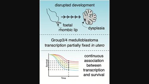 Timing is everything: A connection between medulloblastoma prognosis and foetal cerebellar development.