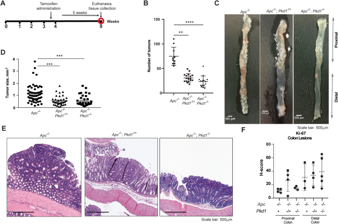 Loss of Pkd1 limits susceptibility to colitis and colorectal cancer.