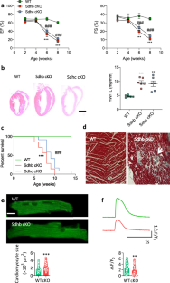 Succinate dehydrogenase is essential for epigenetic and metabolic homeostasis in hearts.