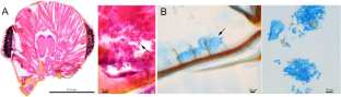 Fungal symbiont community and absence of detectable mycangia in invasive Euplatypus ambrosia beetles