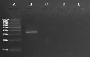 Traceability Assay and Bioinoculant Effects of Two Plant Growth-Promoting Bacillus altitudinis Strains Isolated from Ilex paraguariensis St. Hil.