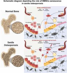 The age-related characteristics in bone microarchitecture, osteoclast distribution pattern, functional and transcriptomic alterations of BMSCs in mice