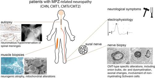 Myelin protein zero mutation-related hereditary neuropathies: Neuropathological insight from a new nerve biopsy cohort