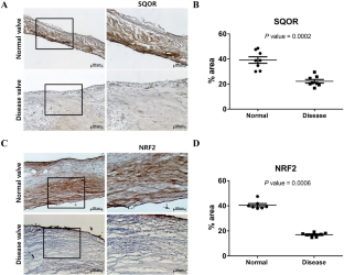 Hydrogen sulfide inhibits gene expression associated with aortic valve degeneration by inducing NRF2-related pro-autophagy effect in human aortic valve interstitial cells.