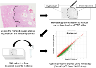 Pregnancy-specific beta-1-glycoprotein 6 is a potential novel diagnostic biomarker of placenta accreta spectrum.