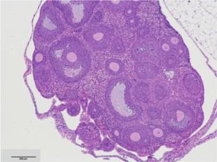 Exploring the impact of ovariectomy on hair growth: can ovariectomized mouse serve as a model for investigating female pattern hair loss in humans?