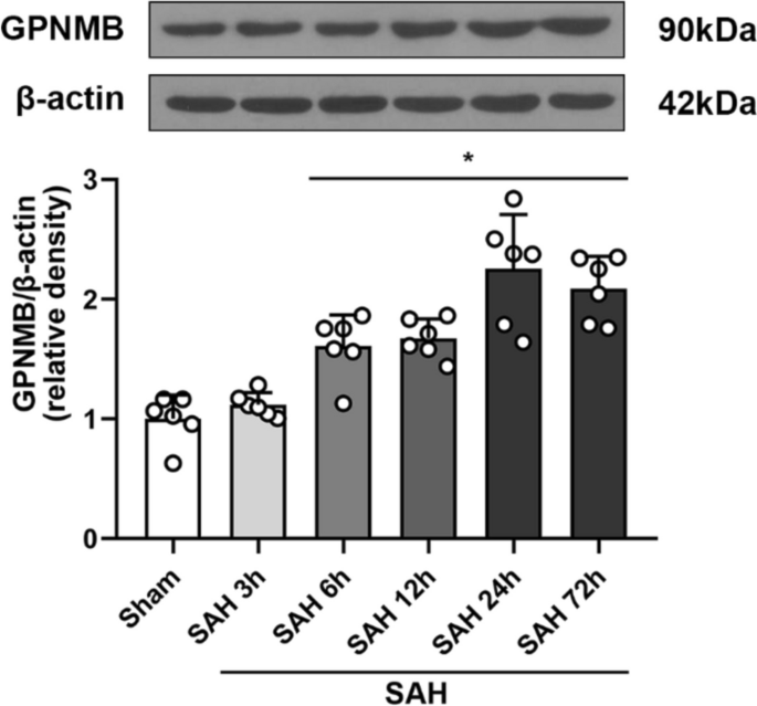 GPNMB Ameliorates Neuroinflammation Via the Modulation of AMPK/NFκB Signaling Pathway After SAH in Mice.